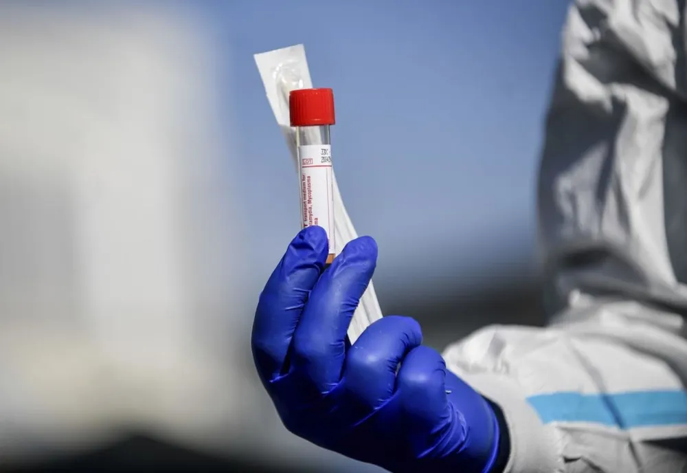 3.855 de cazuri noi de persoane infectate cu SARS – CoV - 2 şi 73 de decese