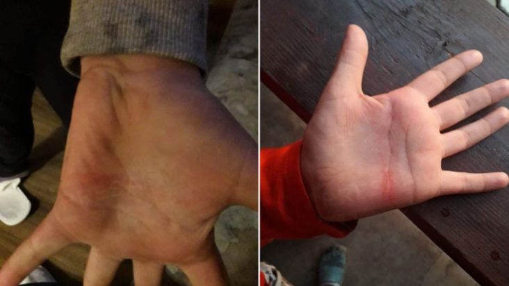 Doar unul dintre cele două cazuri de violență s-a confirmat