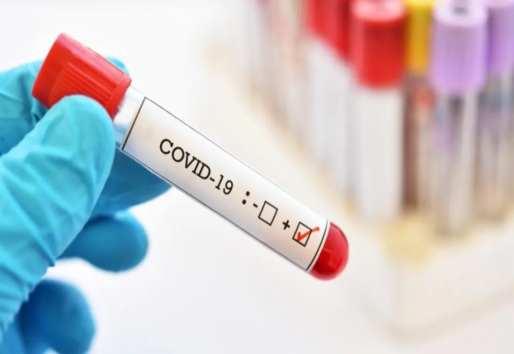 COVID-19 | 52 persoane vindecate, opt decedate și două internate în spital