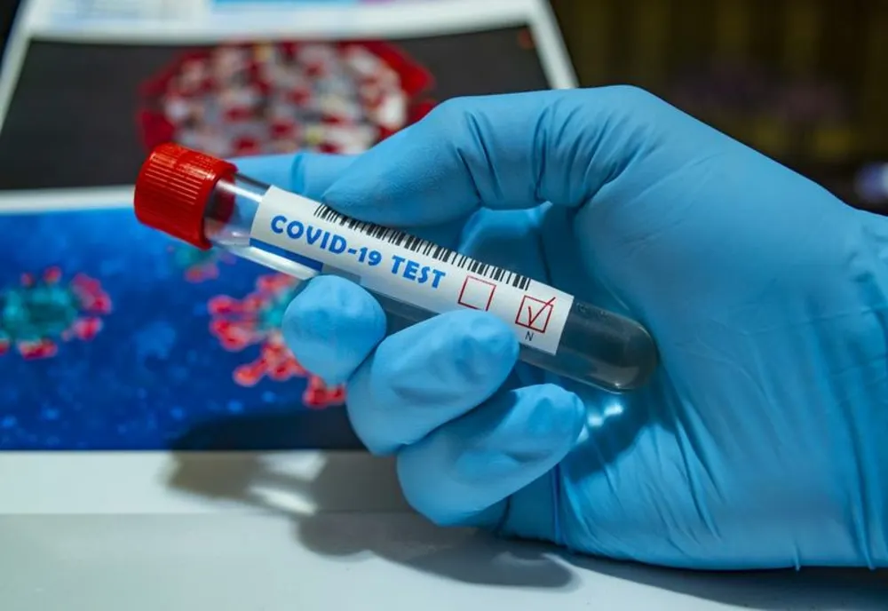 Bilanț coronavirus 28 ianuarie: 31.724 cazuri noi și 60 decese