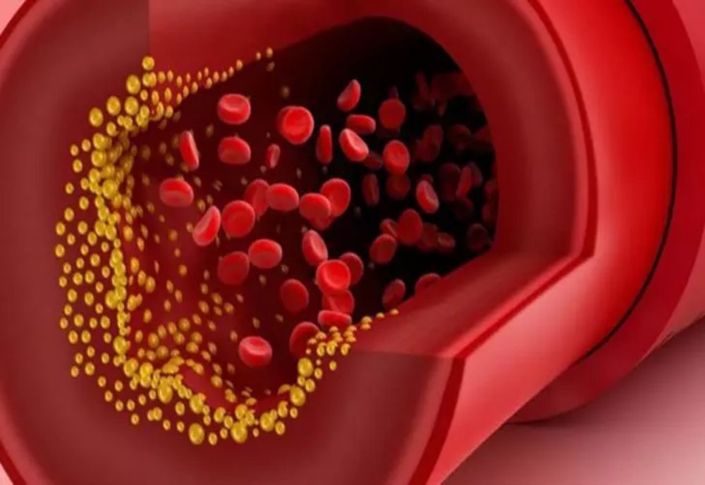Singurul aliment care scade colesterolul și curăță vasele de sânge