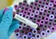 Sătmăreanul infectat cu noul coronavirus, transferat la Clinica de Boli Infecțioase din Cluj